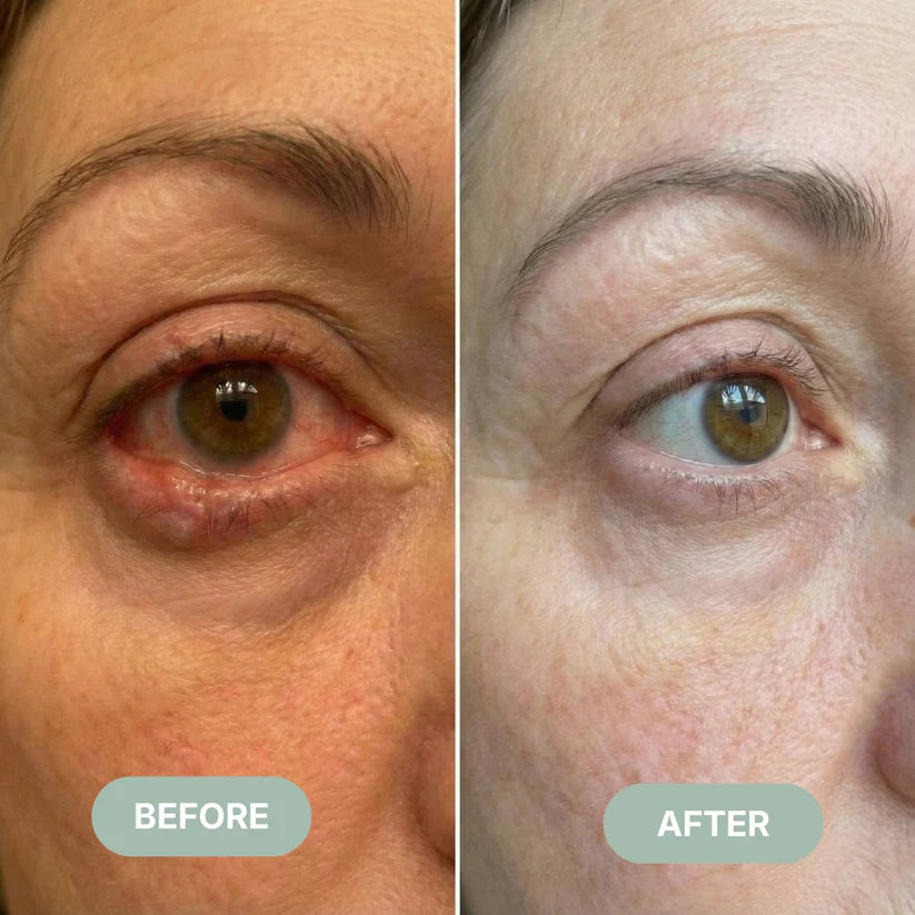 (NEW) Eye Comfort PRO